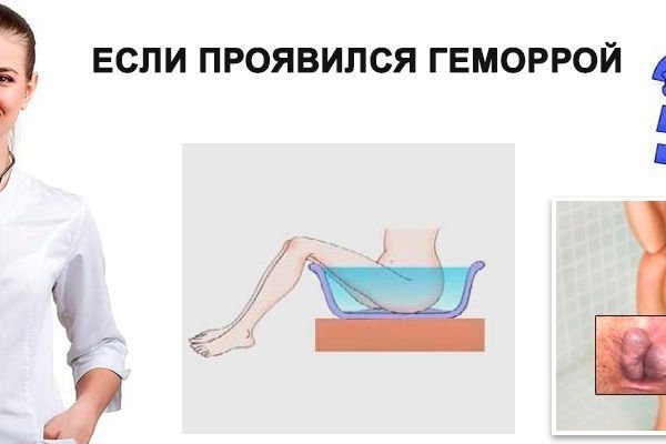 Кракен ссылка 2web